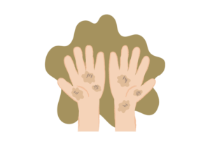 汚れた手のひらのイラスト
